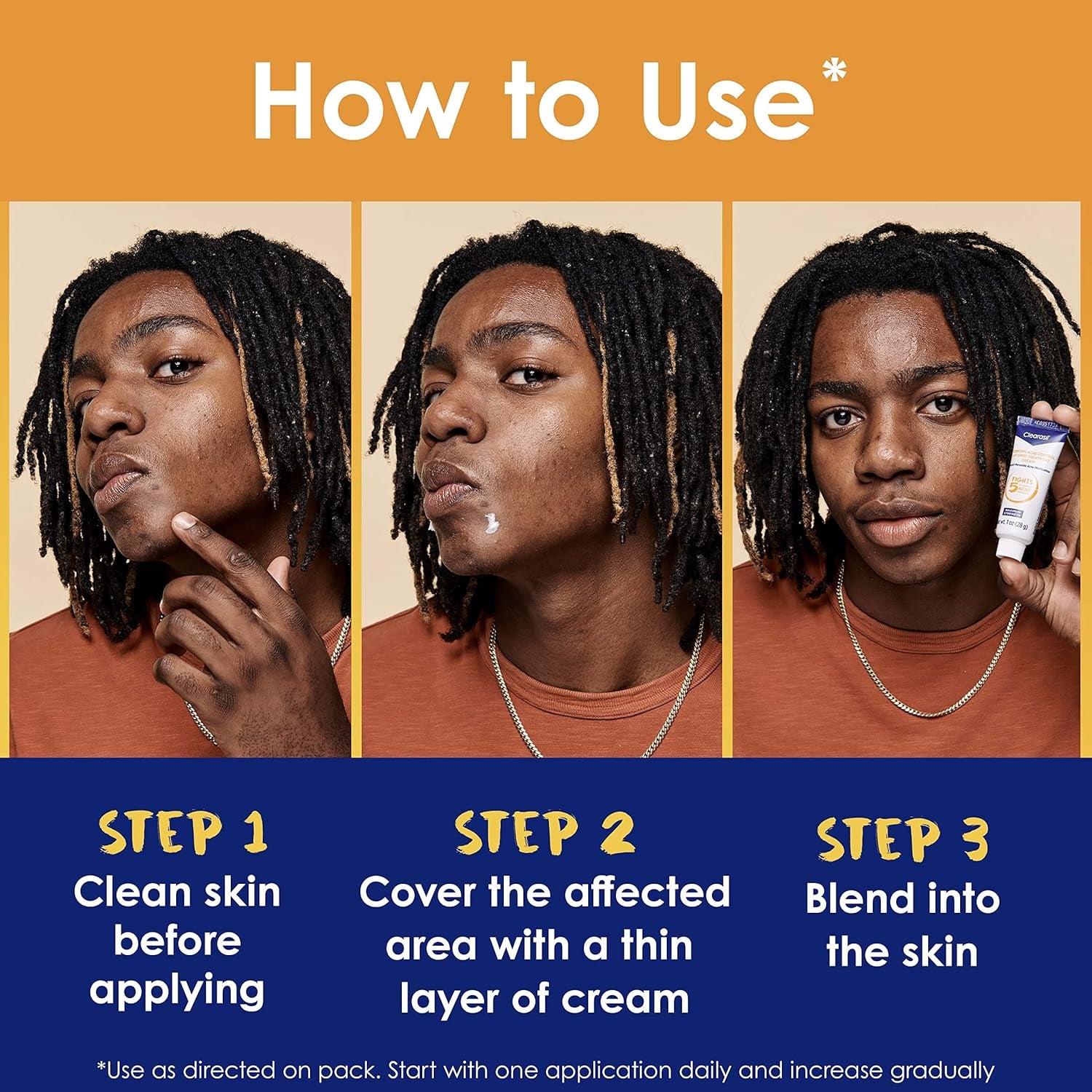 Stubborn Acne Control 5In1 Spot Treatment Cream, Maximum Strenght with 10% Benzoyl Peroxide, Acne Medication, 1 Oz