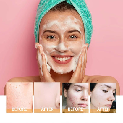 Turmeric Facial Cleanser, Turmeric Foaming Facial Cleanser + Tumeric 𝐇y𝐚lu𝐫o𝐧ic Acid Serum, Face Skincare Deep Cleaning Moisturizing for All Skin (2,Combo)