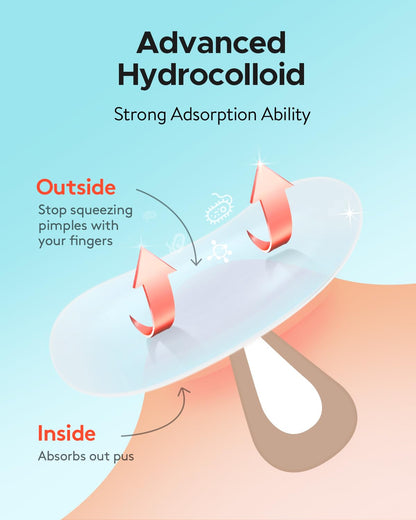 Acne Patches Large, Hydrocolloid Pimple Patches for Large Breakouts, Zit and Blemish, Large Acne Patches for Face, Chin, Back and Body with Tea Tree Oil