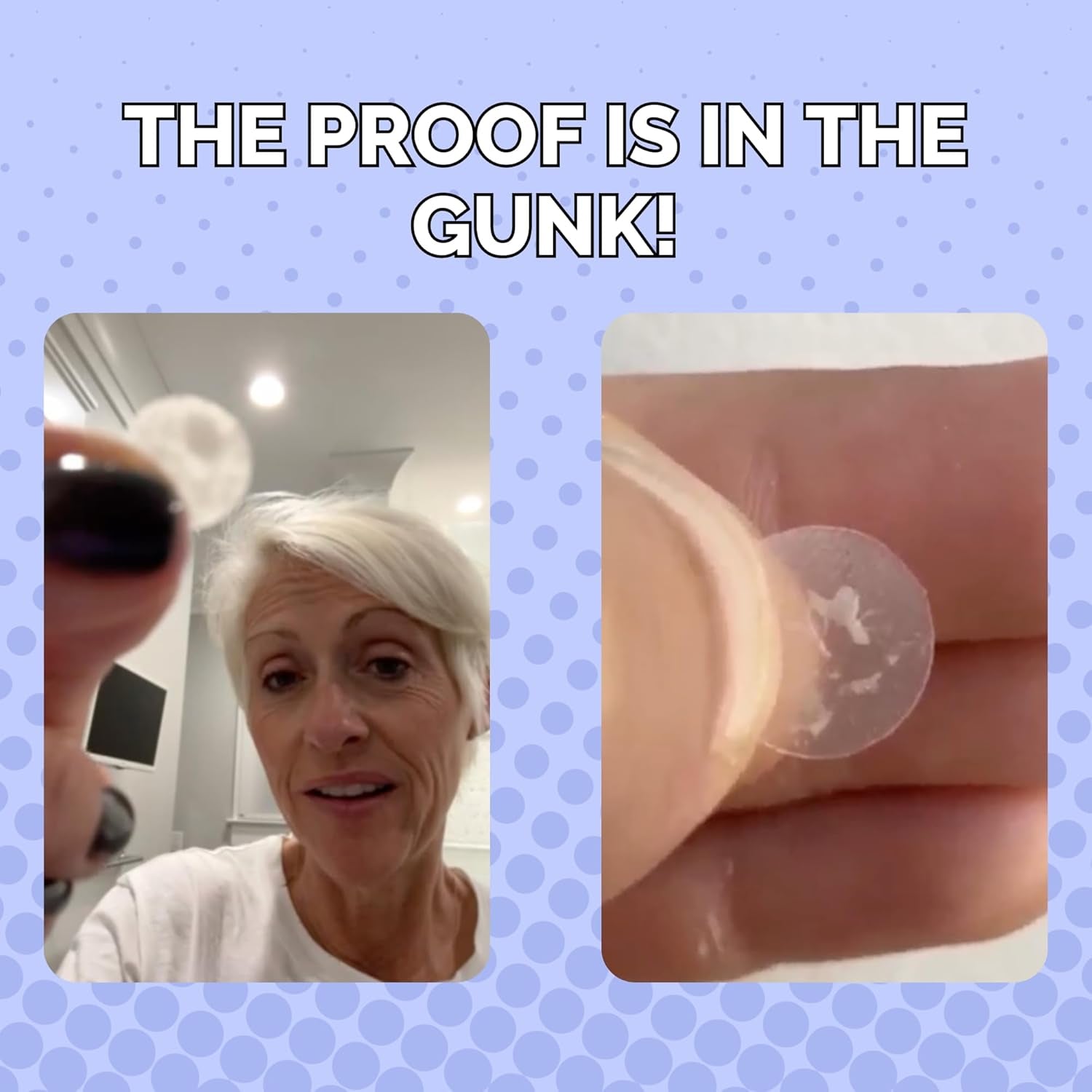 Spot Rescue Blemish Patches with Salicylic Acid & Teatree– Hydrocolloid Spot Stickers for Zits & Blemishes, Transparent for Day & Night, Vegan & Cruelty-Free Skincare Product (36 Count)