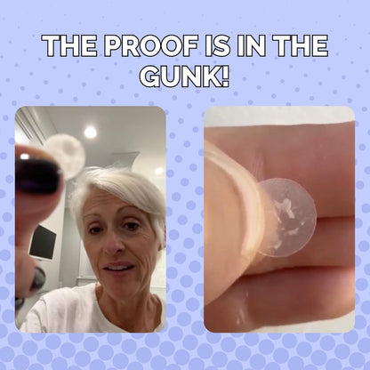 Spot Rescue Blemish Patches with Salicylic Acid & Teatree– Hydrocolloid Spot Stickers for Zits & Blemishes, Transparent for Day & Night, Vegan & Cruelty-Free Skincare Product (36 Count)