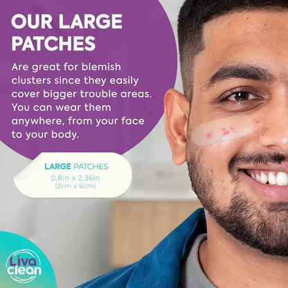 20 CT  Large Hydrocolloid Acne Patches - for Pore Spots Nose Face Cystic Pimple Zit Patch - Big Pimple Patches Hydrocolloid Bandages Strips